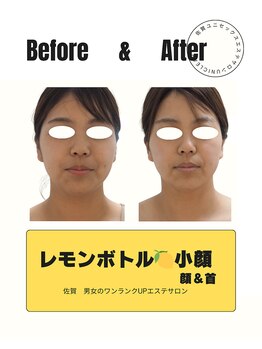 ユニクリア(Uni clear)/【美容歴17年】レモンボトル小顔