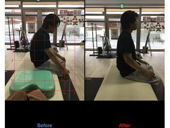 ストレチックス 近江八幡店/姿勢改善ビフォーアフター1回