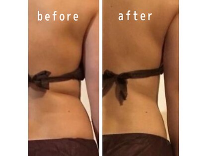 ボディメイクサロン アクア(aqua)の写真