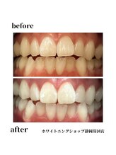 ホワイトニングショップ 葵区静岡駅店/ホワイトニング店ホワイトニング