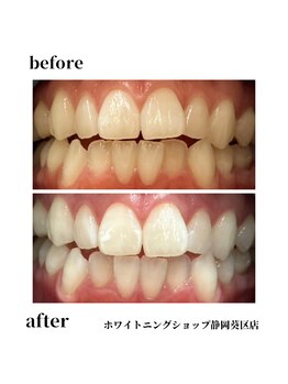 ホワイトニングショップ 葵区静岡駅店/ホワイトニング店ホワイトニング