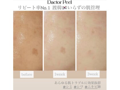 シュシュ(chouchou)の写真