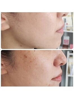 クレビア(CREBIA)の写真/【沖縄初の最先端美容】で毛穴・たるみ・エイジングケアに◎ 臍帯由来成分配合で肌悩みを徹底的に改善！
