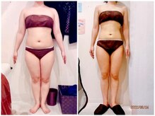 パーフェクトボディプレミアム 名古屋駅前店(PERFECT BODY PREMIUM)/お客様　ビフォーアフター（28）