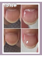 ハッチネイル(HACCI nail)/お客様BEFORE/AFTER 1か月半