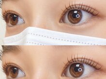 リトマス(LITMUS)