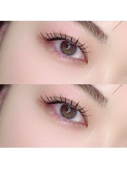 サン(SUN)/フラット160本