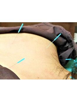 首・肩のつらさを改善したい