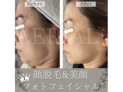 エアリアル 博多店の写真