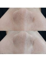 ヴェルシック(Belchic)/毛穴レスも同時に叶う