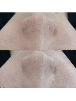 ヴェルシック(Belchic)/毛穴レスも同時に叶う