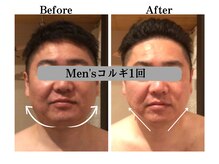 ベリール(BELIRE)/コルギでイメージチェンジ→