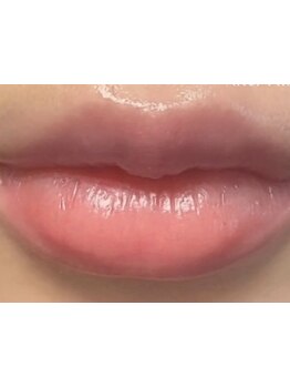 お肌をきれいにしたい