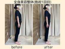 ヴィーネス(VIENESS)/【全身美容整体/マッサージ】