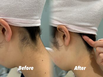 クイーン 渋谷店(QUEEN)/自信が持てる後ろ姿へ