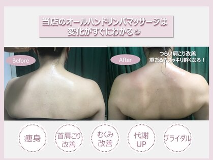 ローゼプランテ 小杉店の写真