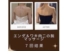 クリエーヌ 目黒店の雰囲気（だぶつくワキ肉/二の腕/肩こり/巻肩/エンダ＆セレクトマッサージ）