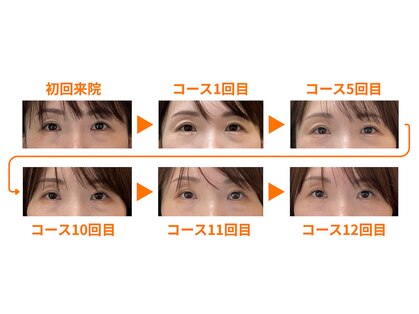 シルエラバレ(CiruelaValle)の写真