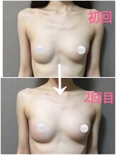 Ms.やまとなでしこ/バストアップ☆ビフォーアフター