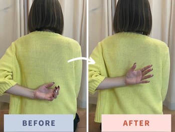 みかん鍼灸整骨院/肩の症状でお悩みの方!