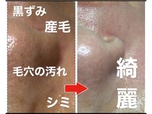 ハルハル(Haru Haru)の雰囲気（毛穴脱毛/黒ずみ/角質肥厚/毛穴開き等改善！スキンケアwax）