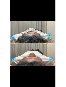 ヴィバランス(Vebalance)/巻き肩に対する矯正