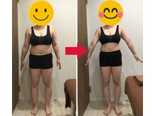 美容整体院元 光の森店/40代Y.M様のビフォーアフター