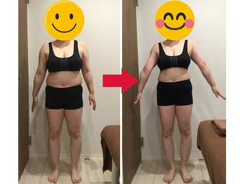 美容整体院元 光の森店/40代Y.M様のビフォーアフター