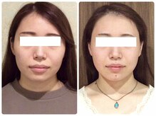 美容整体 ウェリナ 蟹江院/小顔矯正/骨盤矯正/美脚サロン