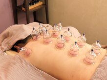 蓄積した疲労にはデトックスカッピングがオススメ[麻布十番]