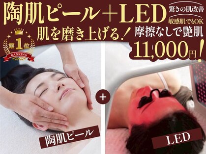 ビアラ(美ala)の写真