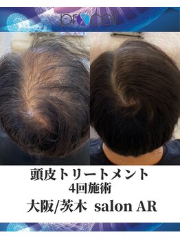 メンズサロンアール(AR)/プロセルセラピーズ