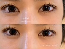 アノカプイル(ankpil)/【パリジェンヌラッシュリフト】