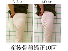 のぞみ整骨院/【助産師さん推薦】産後骨盤ケア