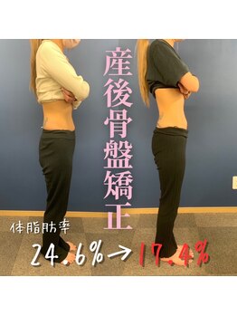 こうぞう整体院/産後骨盤ダイエット