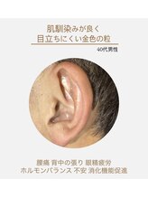 ソウ(SOU)/耳ツボジュエリー