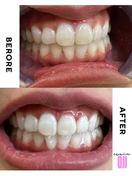 エクシアホワイトニング 王寺店/