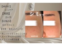 アールエーサロン 恵比寿 広尾(Ra salon)/シミケア