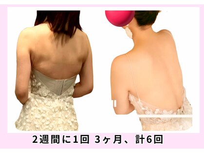 ユルポ(YuREPOS)の写真