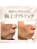 【たるみ・フェイスライン】頭皮から引き上げる極上リフトアップ120分