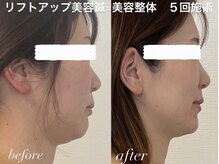 めい鍼灸院の雰囲気（身体の歪み・骨格筋を整え、根本から小顔美人へ）