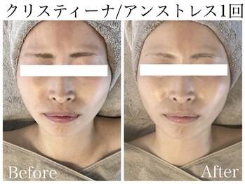 フルール(FLEUR)/クリスティーナ/アンストレス