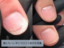 アリエ(allie)/ノンストレスで爪悩み解消！？