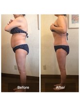 マジカルココ 東久留米店(マジカルCoCo)/姿勢矯正でシルエットもきれいに