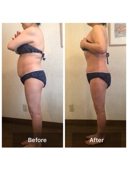 マジカルココ 東久留米店(マジカルCoCo)/姿勢矯正でシルエットもきれいに