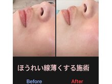 美容矯正サロン レレポノ(LELEPONO)/