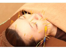 さくら鍼灸整骨院/美容鍼/毛穴/小顔/子連れOK