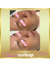 アイリープ(eyeleap)/☆【水光保湿肌美人】