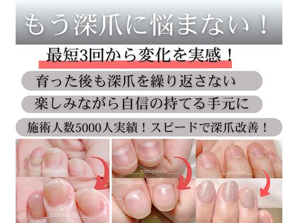 リミーネイルズ(rimiynails)の写真