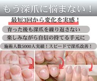 リミーネイルズ(rimiynails)